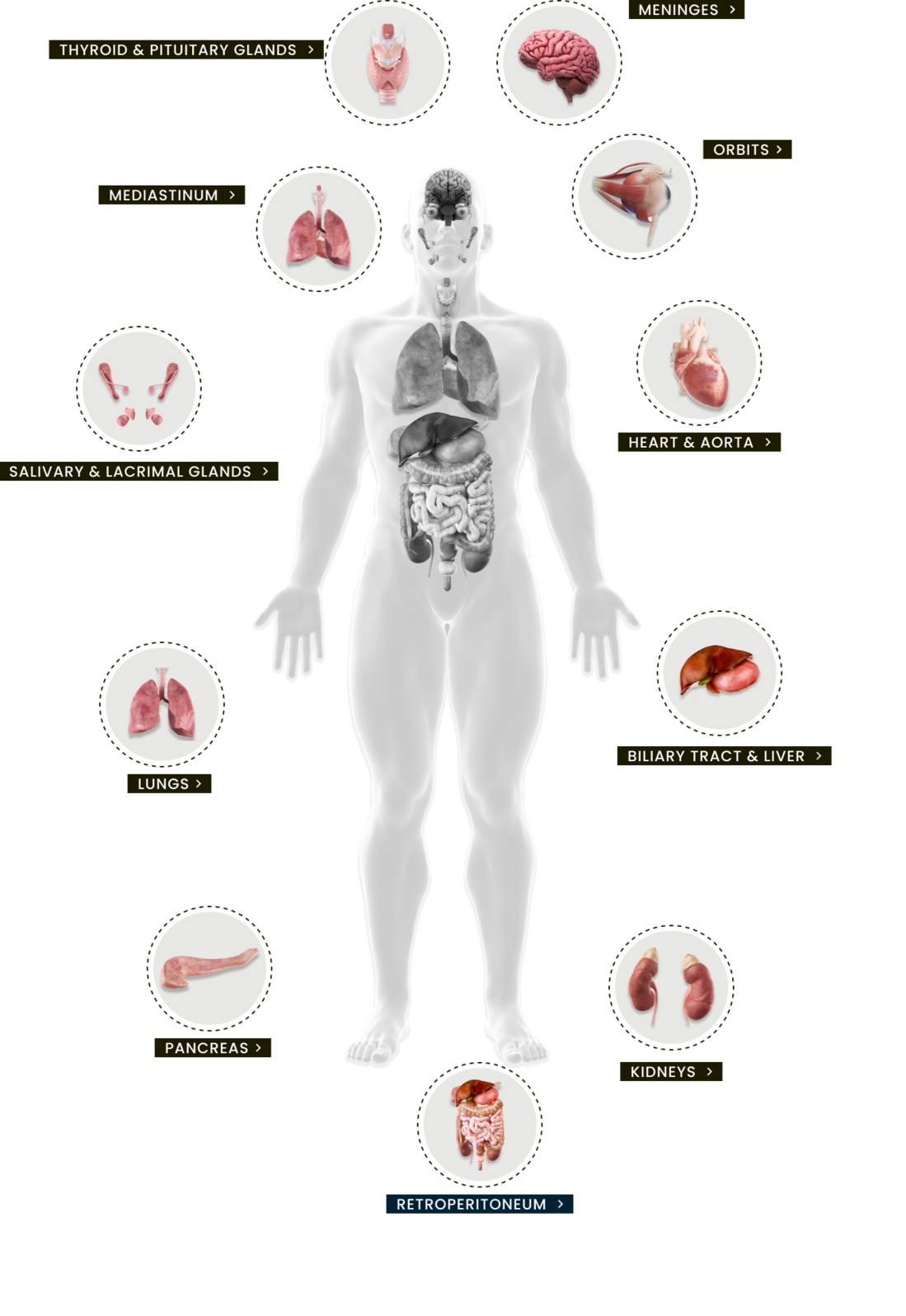 Illustration of human body affected by IgG4-related disease symptoms, identifying IgG4-RD manifestations in meninges, orbits, heart and aorta, biliary tract and liver, kidneys, retroperitoneum, pancreas, lungs, salivary and lacrimal glands, mediastinum, and thyroid and pituitary glands